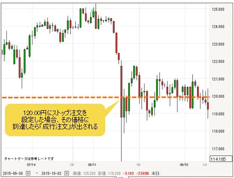 IG証券「ストップ注文」